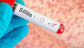 Salud implementa capacitación obligatoria para fortalecer la lucha contra la sífilis